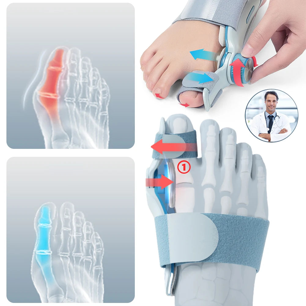 Bunion Corrector